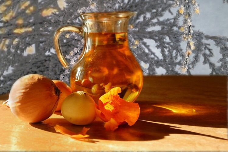 sīpolu novārījums prostatīta ārstēšanai